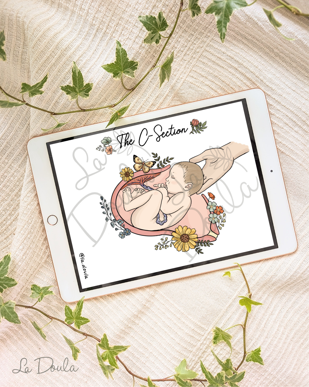 C-Section Illustration (Color version)