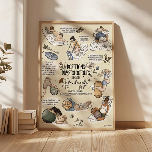 Affiche POSITIONS PHYSIOLOGIQUES PÉRIDURALE